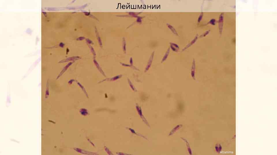 Лейшмании Abanima 