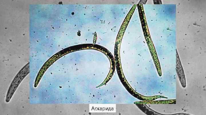 Аскарида 