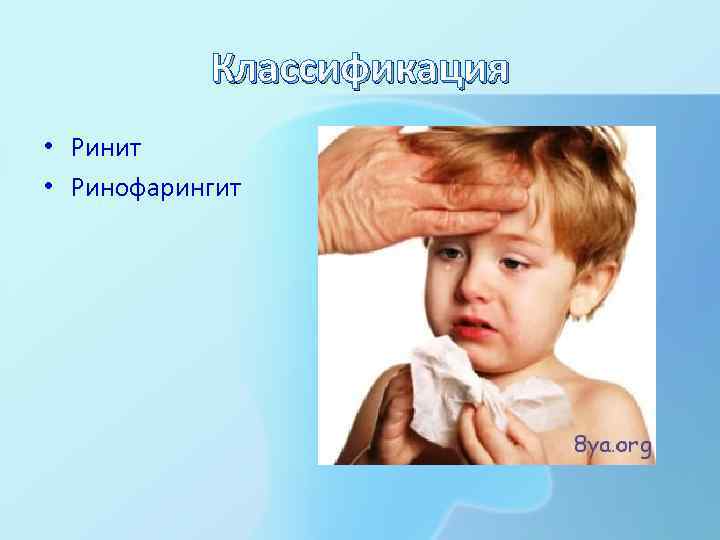 Классификация • Ринит • Ринофарингит 