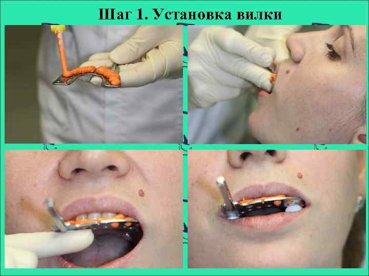 Шаг 1. Установка вилки 