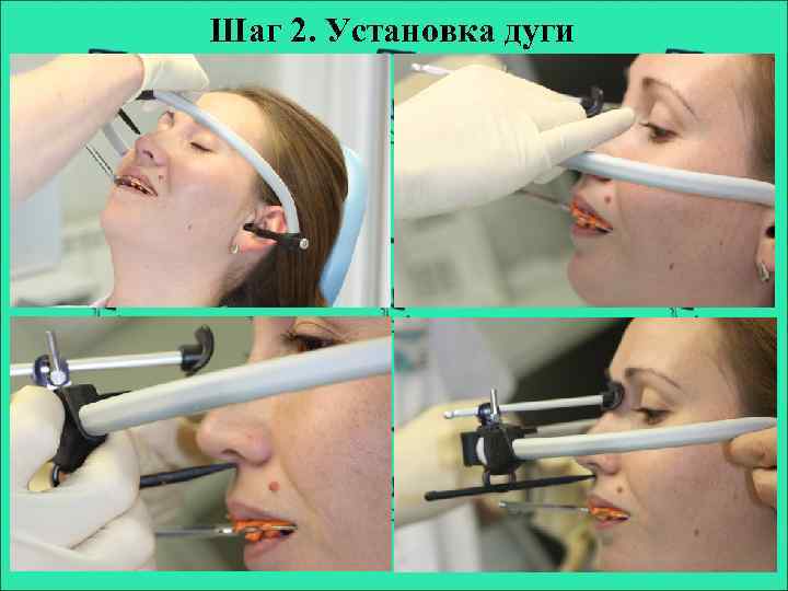 Шаг 2. Установка дуги 