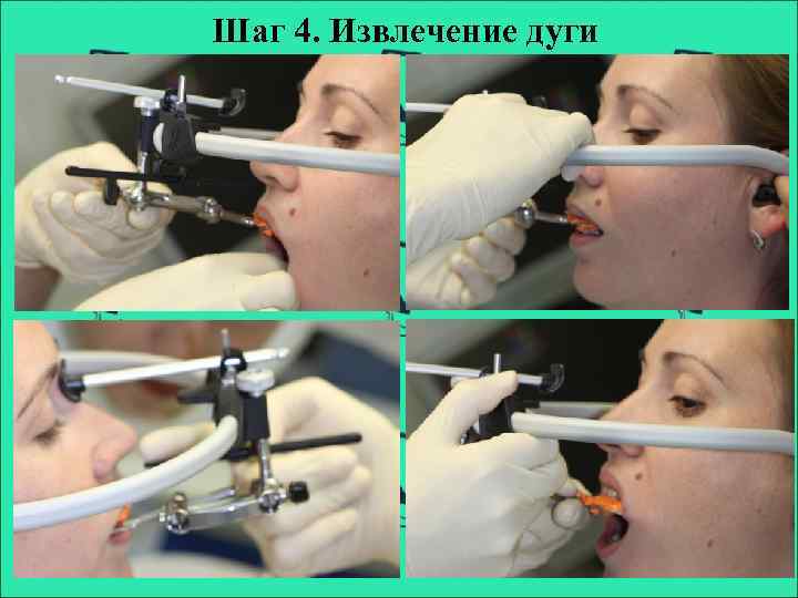 Шаг 4. Извлечение дуги 