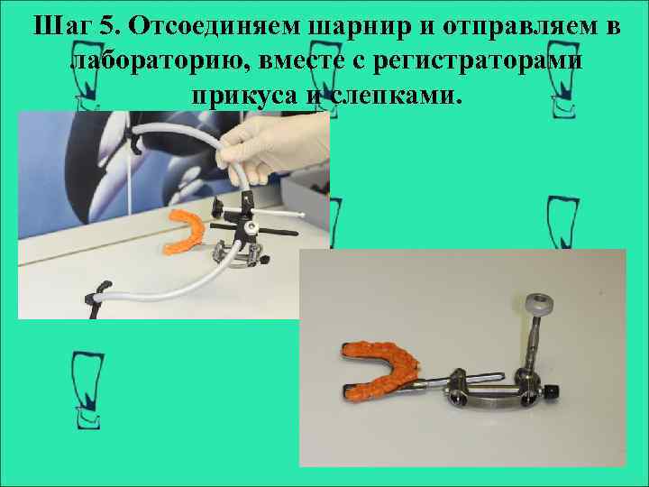 Шаг 5. Отсоединяем шарнир и отправляем в лабораторию, вместе с регистраторами прикуса и слепками.