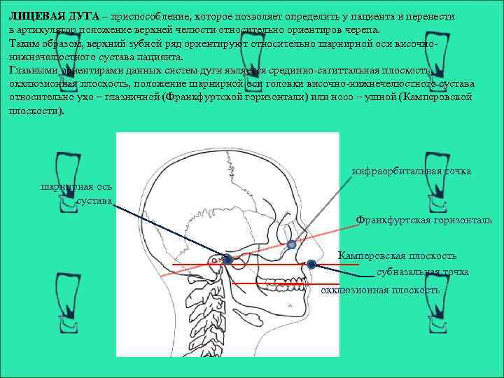 ЛИЦЕВАЯ ДУГА – приспособление, которое позволяет определить у пациента и перенести в артикулятор положение