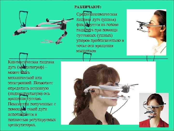 Лицевая дуга презентация