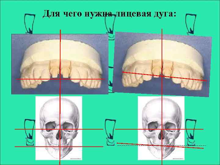 Лицевая дуга презентация