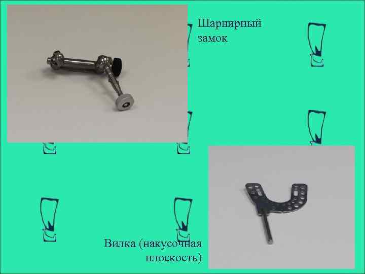Шарнирный замок Вилка (накусочная плоскость) 
