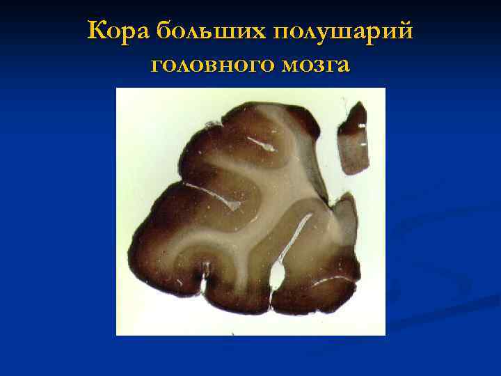 Кора больших полушарий головного мозга 