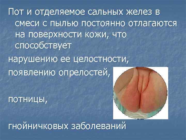 Пот и отделяемое сальных желез в смеси с пылью постоянно отлагаются на поверхности кожи,