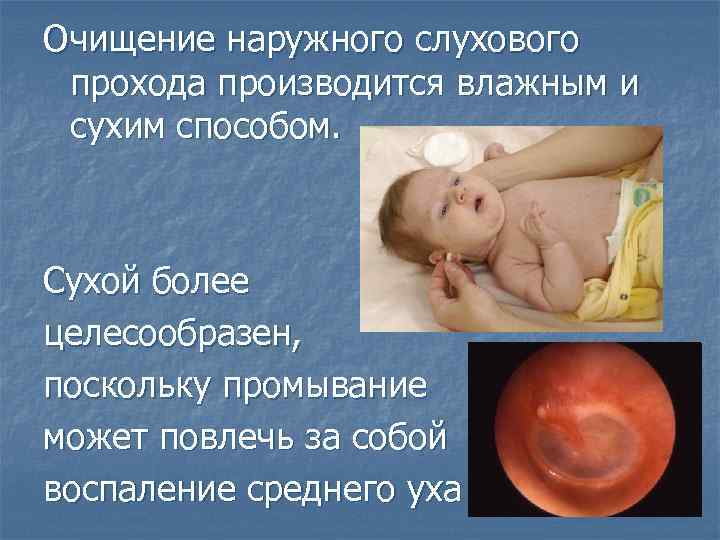 Очищение наружного слухового прохода производится влажным и сухим способом. Сухой более целесообразен, поскольку промывание