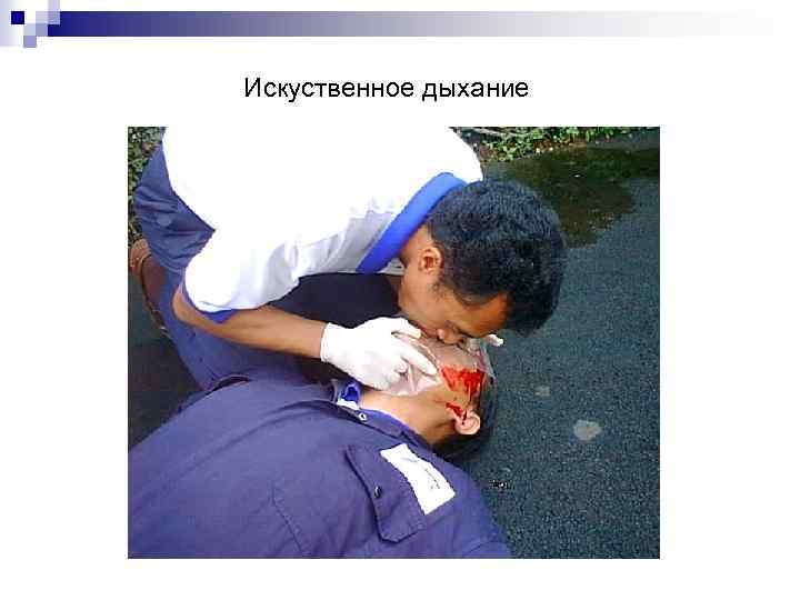 Искуственное дыхание 