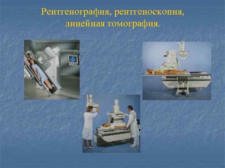 Рентгенография, рентгеноскопия, линейная томография. 