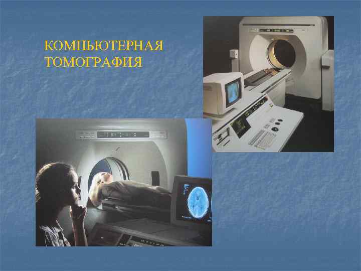 КОМПЬЮТЕРНАЯ ТОМОГРАФИЯ 