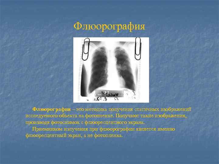Флюорография – это методика получения статичных изображений исследуемого объекта на фотопленке. Получают такие изображения,