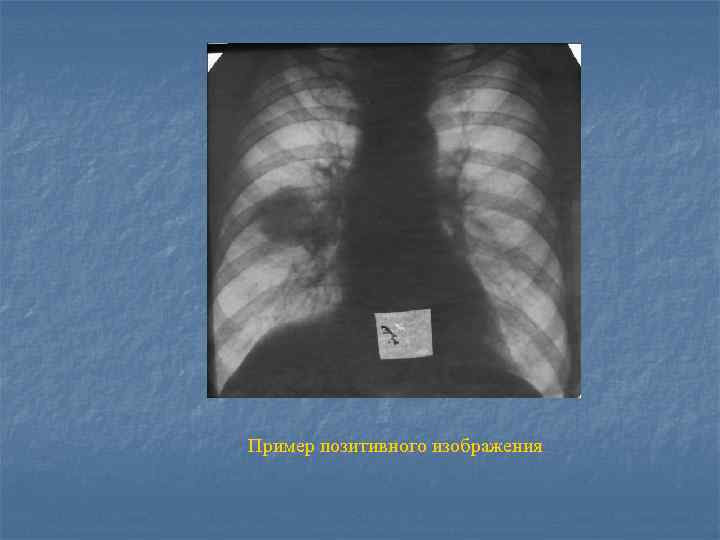 Пример позитивного изображения 