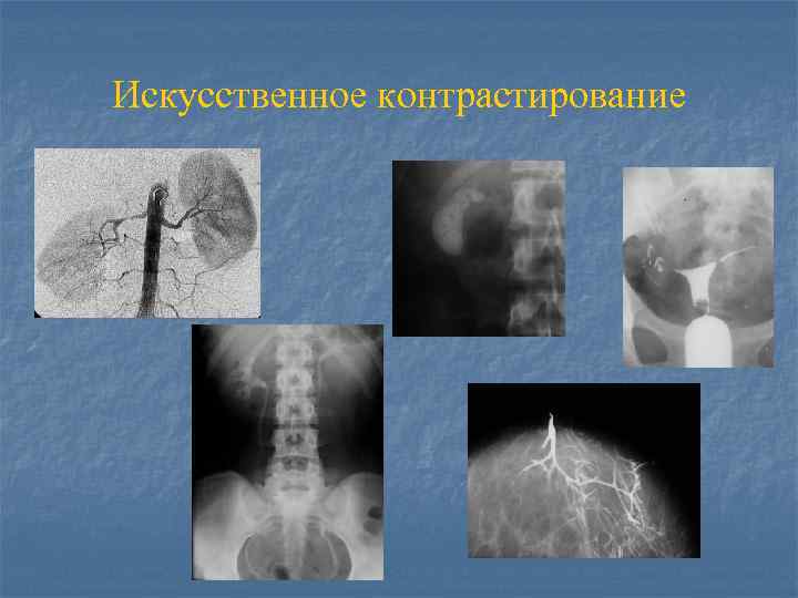 Основы лучевой диагностики от изображения к диагнозу