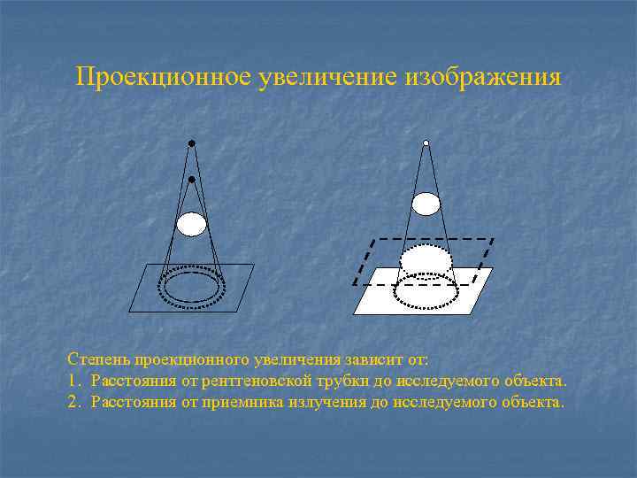 Проекционное увеличение изображения Степень проекционного увеличения зависит от: 1. Расстояния от рентгеновской трубки до