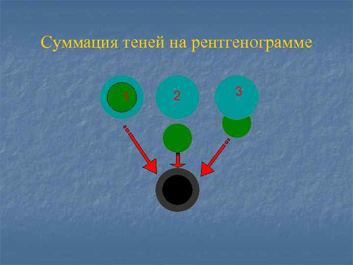 Суммация теней на рентгенограмме 1 2 3 