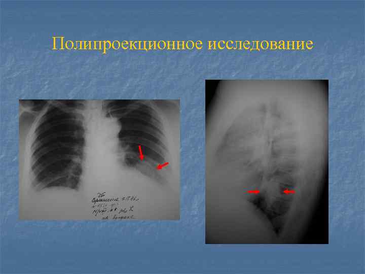 Полипроекционное исследование 