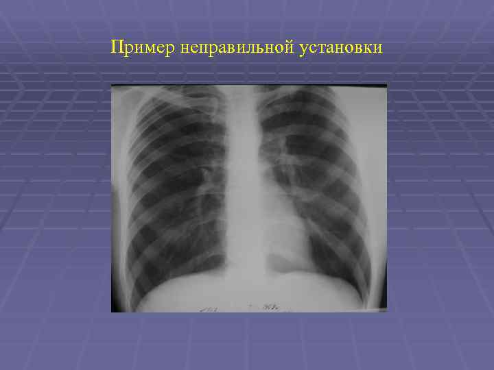 Пример неправильной установки 