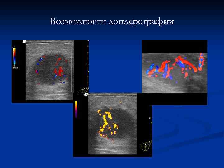 Возможности доплерографии 