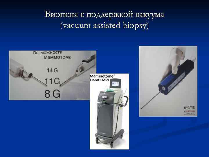 Биопсия с поддержкой вакуума (vacuum assisted biopsy) 