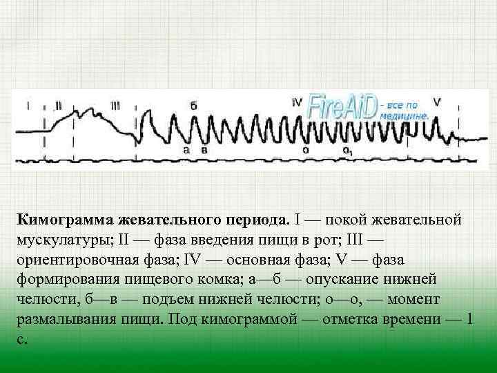 Кимограмма жевательного периода. I — покой жевательной мускулатуры; II — фаза введения пищи в
