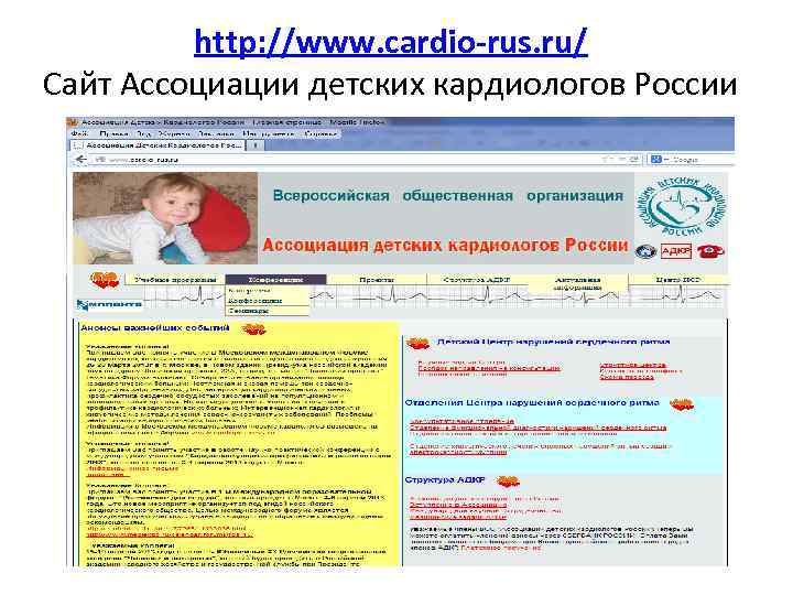 http: //www. cardio-rus. ru/ Сайт Ассоциации детских кардиологов России 