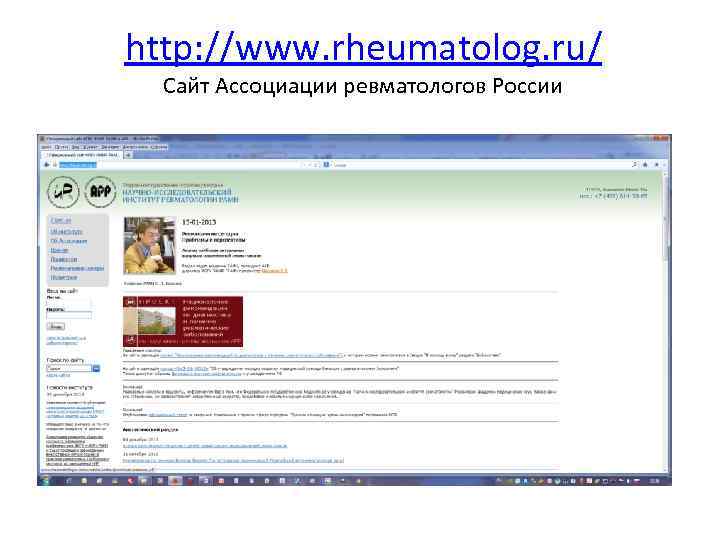 http: //www. rheumatolog. ru/ Сайт Ассоциации ревматологов России 