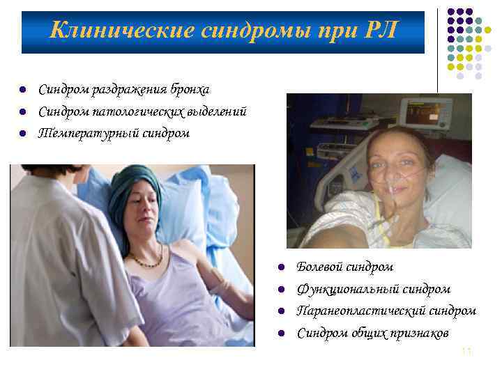Клинические синдромы при РЛ l l l Синдром раздражения бронха Синдром патологических выделений Температурный
