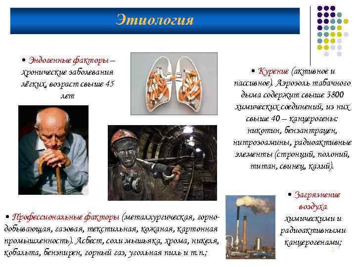 Этиология • Эндогенные факторы – хронические заболевания лёгких, возраст свыше 45 лет • Профессиональные