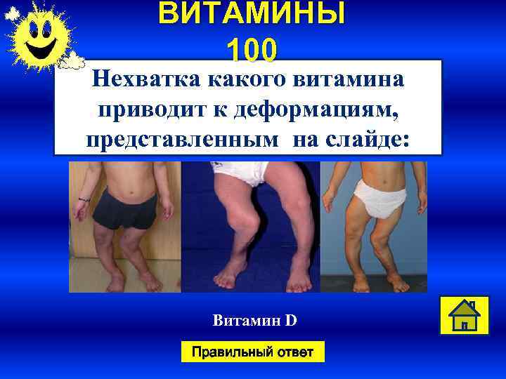 ВИТАМИНЫ 100 Нехватка какого витамина приводит к деформациям, представленным на слайде: Витамин D Правильный