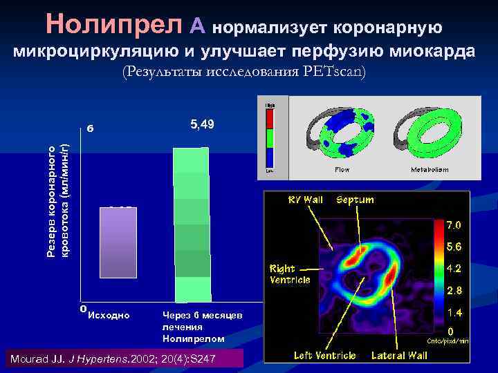 Нолипрел А нормализует коронарную микроциркуляцию и улучшает перфузию миокарда (Результаты исследования PETscan) 5, 49