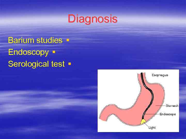 Diagnosis Barium studies § Endoscopy § Serological test § 