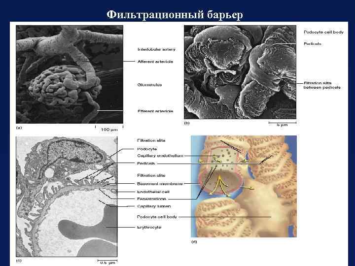 Фильтрационный барьер 
