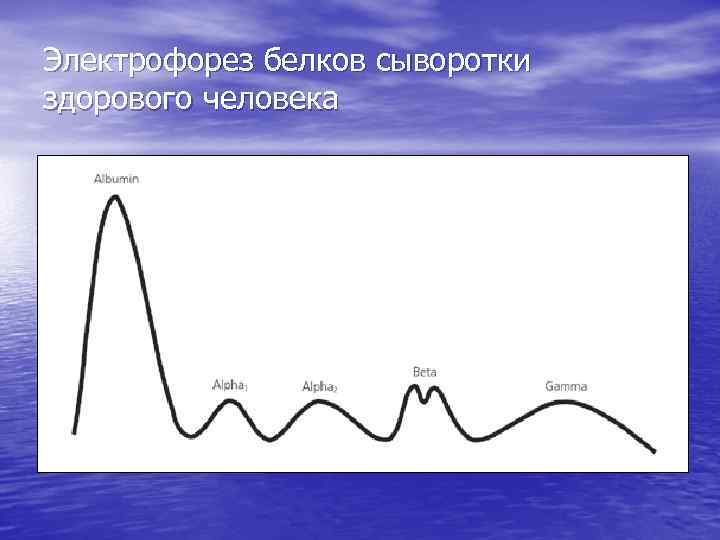 Электрофорез белков сыворотки здорового человека 