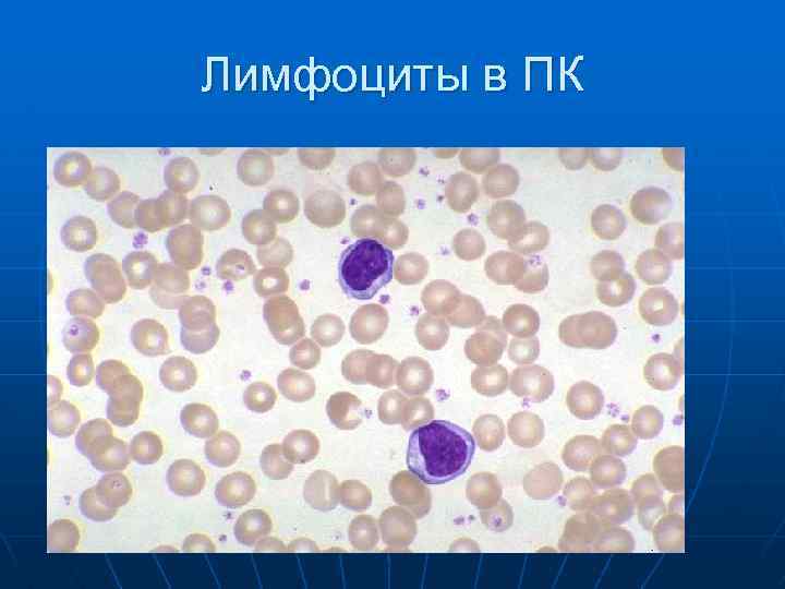 Лимфоциты в ПК 