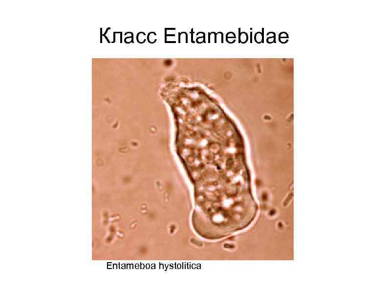 Класс Entamebidae Entameboa hystolitica 