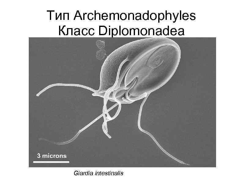 Тип Archemonadophyles Класс Diplomonadea Giardia intestinalis 