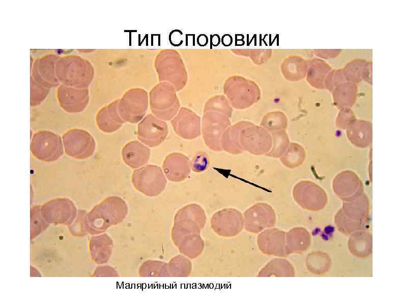 Тип Споровики Малярийный плазмодий 