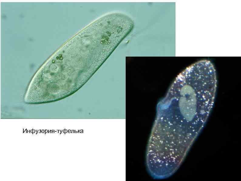 Инфузория-туфелька 