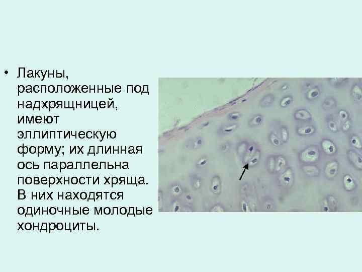 Аппозиционный рост хряща. Классификация хрящей гистология. Лакуна гиалиновый хрящ. Хрящевая ткань.