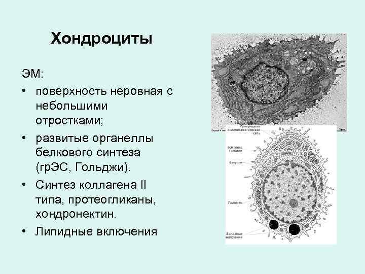 Хондроциты типы. Хондроциты функции. Вид ткани хондроцит. Пероксисома строение.