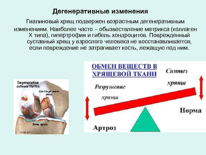 Дегенеративные изменения Гиалиновый хрящ подвержен возрастным дегенеративным изменениям. Наиболее часто – обызвествление матрикса (коллаген