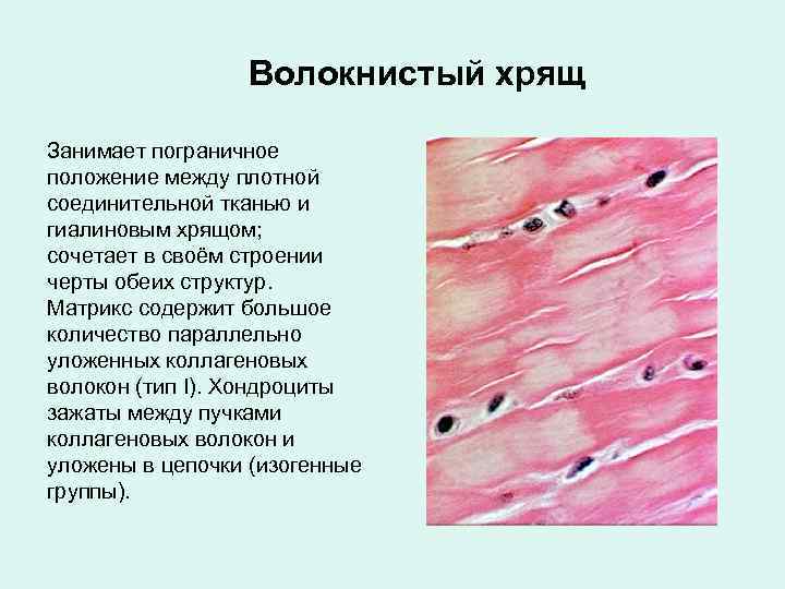 Волокнистый хрящ рисунок с подписями