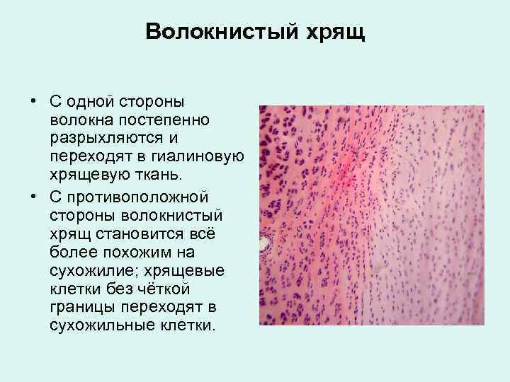 Волокнистый хрящ гистология рисунок