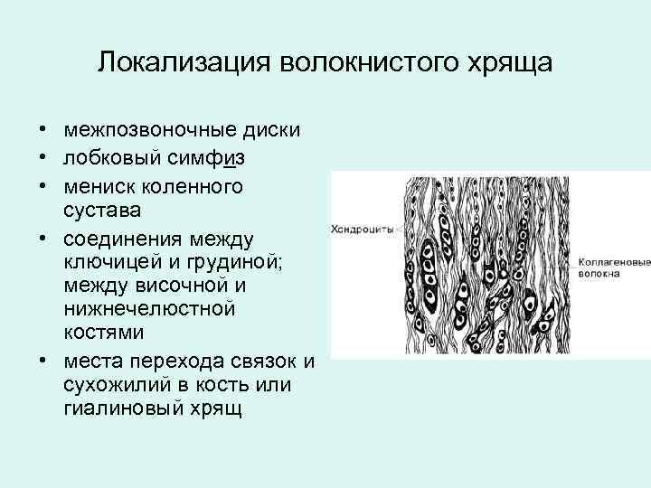 Локализация волокнистого хряща • межпозвоночные диски • лобковый симфиз • мениск коленного сустава •