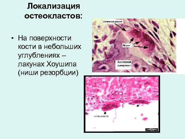 Локализация остеокластов: • На поверхности кости в небольших углублениях – лакунах Хоушипа (ниши резорбции)