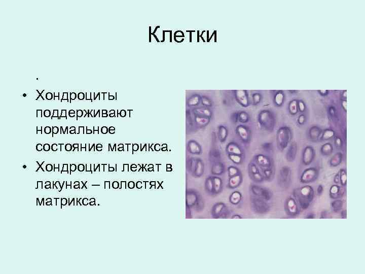 Клетки. • Хондроциты поддерживают нормальное состояние матрикса. • Хондроциты лежат в лакунах – полостях