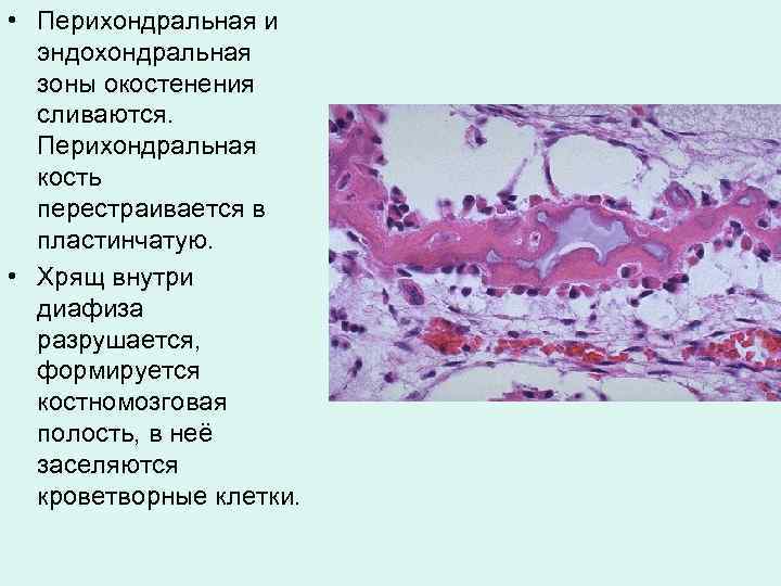  • Перихондральная и эндохондральная зоны окостенения сливаются. Перихондральная кость перестраивается в пластинчатую. •